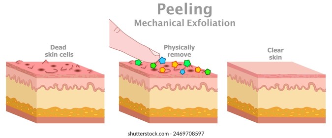 Peeling, mechanisches Peeling. Körperlich mit Finger, Pinsel schrubben. Saubere Hautpflege, alte abgestorbene Zellen. Vor, nach den Produkten. Menschliche Gesichtsfüller Hautpflege Illustration Vektorgrafik