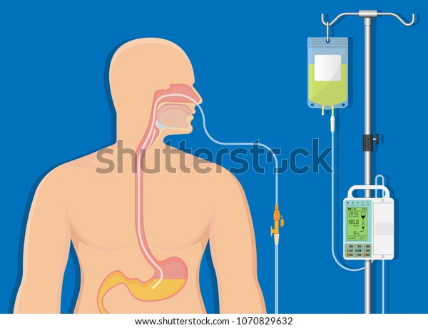 Orogastric Tube Placement