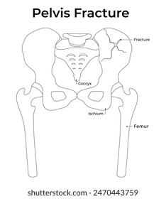 Pelcis Fracture Science Design Vector Illustration Diaram