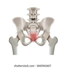 Pelvic arthritis on a white background. 3d vector illustration