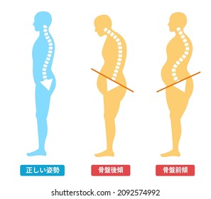 Pelvic forward and backward tilt: Correct posture and body illustration  Translation;Pelvic tilt forward and backward