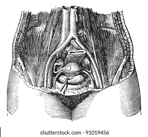 Pelvis of a women, with its soft parts, seen from top to bottom and front to back, vintage engraved illustration. Usual Medicine Dictionary - Paul Labarthe - 1885.