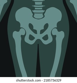 Radiografía de Pelvis, asistencia sanitaria en clínicas u hospitales, diagnóstico y análisis del estado de salud del paciente. Exploración roentgen del cuerpo humano con huesos y articulaciones, examen y cuidado. Vector de estilo plano