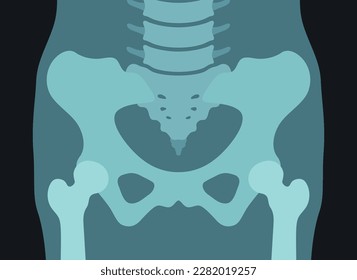 Pelvis x ray picture human anatomy skeleton bone scanning internal checkup radiology shot vector flat illustration. Xray body medical healthcare hospital surgery image skull medicine femur model
