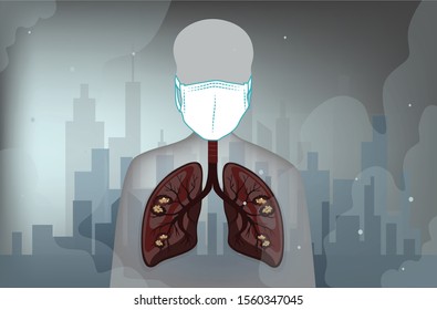 A people in a big city has a high risk to sick a lung cancer from breathing chemical,dust or bad air for long time.