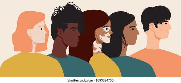 People are isolated. Skin problems, vitiligo, acne, freckles. Flat vector stock illustration. People with different skin colors. Teens and young adults problems. Body positive concept. Face portraits
