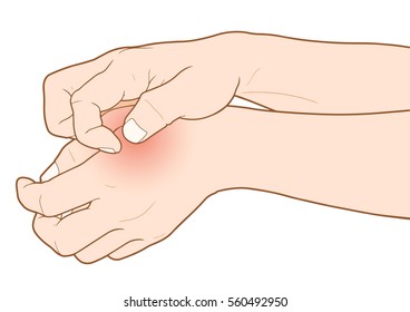 People scratch the itch with hand, Eczema, Arm, Concept with Healthcare And Medicine.