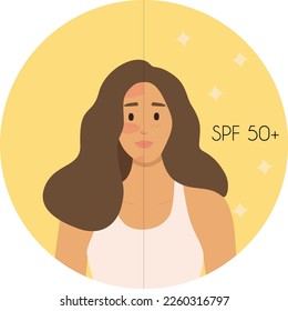 People UV skin protection. Using gel with spf. Sun protection infographic. Vector flat illustration. Skin care, skin care. Burn protection. Use sunscreen