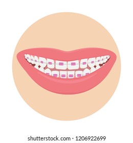 Perfect smile, Hollywood smile, female smile. Correct and even bite of teeth. White teeth, healthy gums, beautiful lips. Vector illustration.