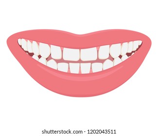 Perfect smile, Hollywood smile. White teeth, healthy gums, beautiful lips. Vector illustration.