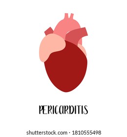 Pericarditis. Heart, cardiovascular diseases. Cardiology. Vector flat illustration. For flyer, medical brochure, banner, landing page, web