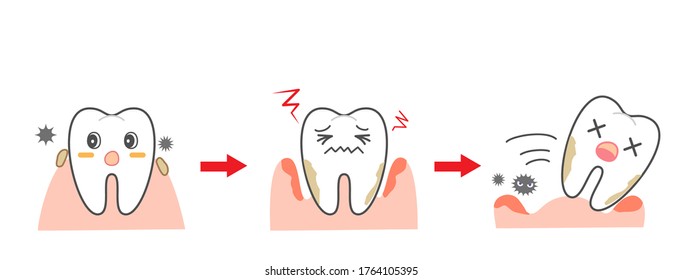 Periodontal disease bleeding toothpaste 　illustrations