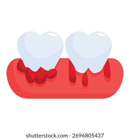 Parodontale Erkrankungen, die Zahnfleischbluten und Gingivitis verursachen