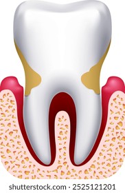 Periodontal disease. Tooth pain. Dental infection drawing