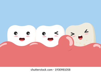 Periodontitis or gum disease with bleeding. Cute cartoon tooth character with gum problem. Vector, illustration, eps, flat design, cartoon 