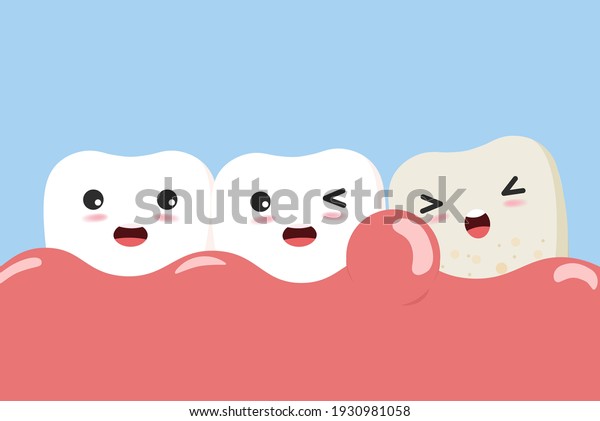 Periodontitis or gum disease with bleeding. Cute cartoon\
tooth character with gum problem. Vector, illustration, eps, flat\
design, cartoon 