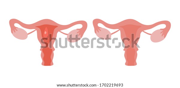 Periods Menstruation Modern Vector Cartoon Uterus Vetor Stock Livre De Direitos 1702219693 5317