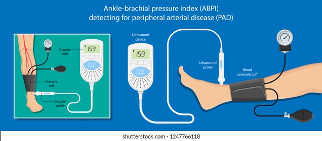 Peripheral Artery Disease Ankle Brachial Index ABI Test Limb Ischemia Diagnosis Vascular ABPI Blockage