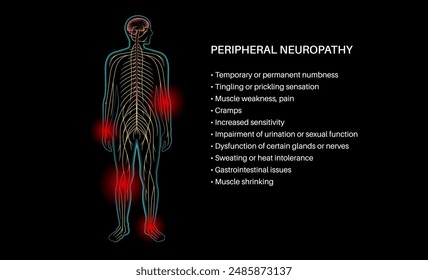 Cartel de neuropatía periférica. Las manos y los pies resaltaron áreas de dolor, entumecimiento y hormigueo. Diabetes o lesiones. Nervios dañados en el sistema nervioso, Ilustración vectorial por deformidad de la vaina de mielina