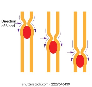 Peristalsis Peristalsis moves food through the digestive tract