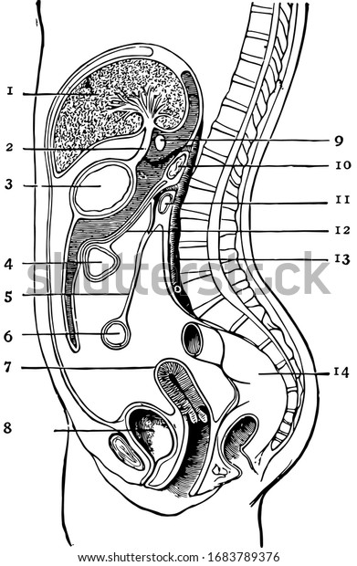 The\
peritoneum is a large serous membrane which forms in the male a\
closed sac the parietal layer of which lines the abdominal walls,\
vintage line drawing or engraving\
illustration.