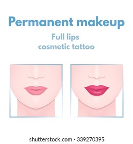 permanent make-up and lip augmentation