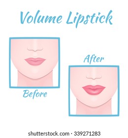 permanent makeup, plastic surgery of lips