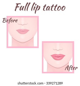 permanent makeup, plastic surgery of lips