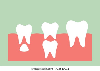 permanent tooth located below primary tooth - dental cartoon vector flat style cute character for design