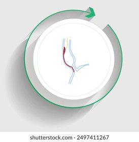 Perorale endoskopische Myotomie ist ein minimal-invasives (weniger traumatisches mit schnellerer Genesung) Verfahren