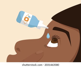 Person applying eyedrops. Medical treatment, pharmacy, irritaion. Can be used for topics like allergy, glaucoma, opthalmology or inflammation