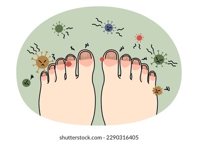 Pies de persona con enfermedad de las uñas o infección. Pie con onicomicosis o hongo en los dedos. Tratamiento médico y procedimiento. El concepto de salud y medicina. Ilustración vectorial plana.