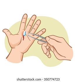 Person injured hand with broken glass, pulling with forceps, caucasian. Ideal for catalogs, informative and institutional guides