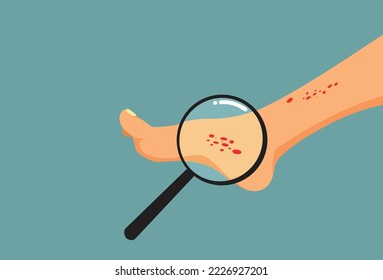 
Person with Skin Eczema on the Foot Going Under Medical Examination. Person undergoing a dermatological examination because of a skin rash
