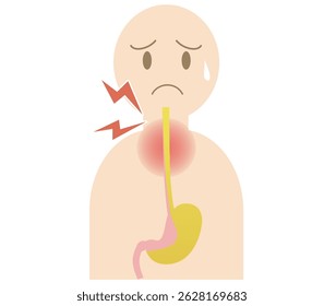 Pessoa com irritação da garganta causada por refluxo ácido devido a doença de refluxo gastroesofágico (DRGE)