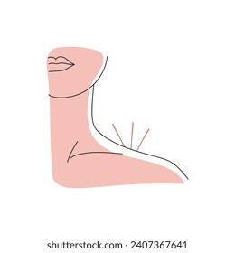 Person undergoing acupuncture on white background