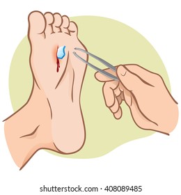 Person walking wounded with broken glass, pulling with forceps, caucasian. Ideal for catalogs, informational and institutional guides