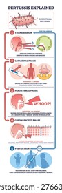 Pertussis explained shows transmission, symptom phases, and prevention, key visuals are Bordetella bacteria, coughing droplets, and vaccine syringe, summarizing disease stages. Outline diagram