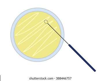 Petrischale mit Nährmedium und Inokulationsschleife