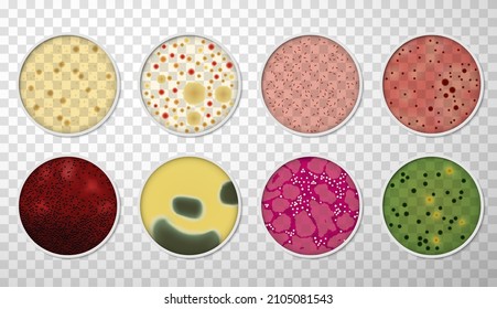 Petri dishes with bacteria and germs colonies set top view realistic vector illustration. Collection microorganism cell bacterium biology virus medical illness. Microbiology research science medicine