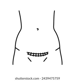 Pfannenstiel Inzisionsliniensymbol. Bauchschnitte. Vektor-isoliertes Element. Bearbeitbarer Strich.