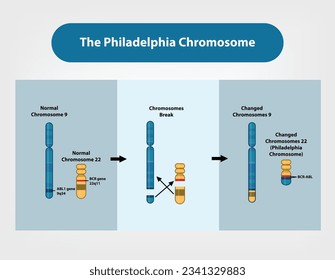 The Philadelphia Chromosome, Genetic abnormality of chromosome 22, which is a factor in chronic myeloid leukemia.