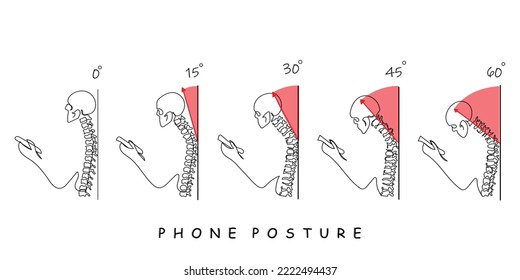 Phone posture while standing for correct spine and neck angle outline diagram. Healthy smartphone browsing from anatomical view vector illustration. Head weight problem and potential medical injury.