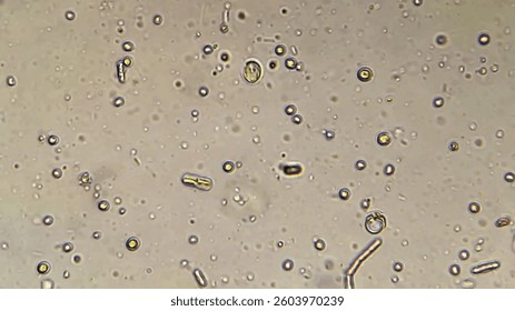 A photograph of microorganisms in a nutrient medium, visible through an optical microscope in the transmitted light of a tungsten incandescent lamp.