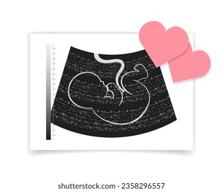 Photograph of an ultrasound of an unborn baby embryo and red hearts. Illustration, postcard, vector