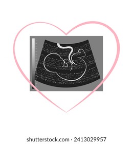 Photograph of an ultrasound of an unborn baby embryo in a heart. Illustration, postcard, vector