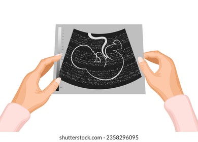 Photograph of an ultrasound of an unborn baby's embryo in the mother's hands. Illustration, vector