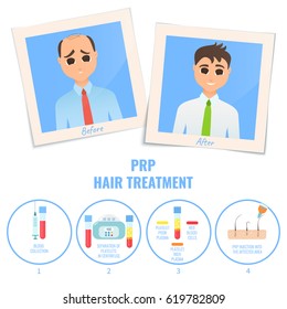 Photographs of a man before and after PRP treatment. Platelet rich plasma procedure stages. Male hair loss design template. Alopecia medical concept. Vector illustration.
