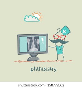 phthisiatry chest X-ray shows