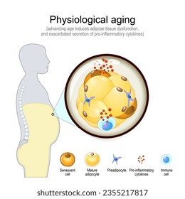 Physiological Aging. Cellular senescence and Adipocyte changes with age. Aging process, Insulin resistance and diabetes. Vector illustration svg